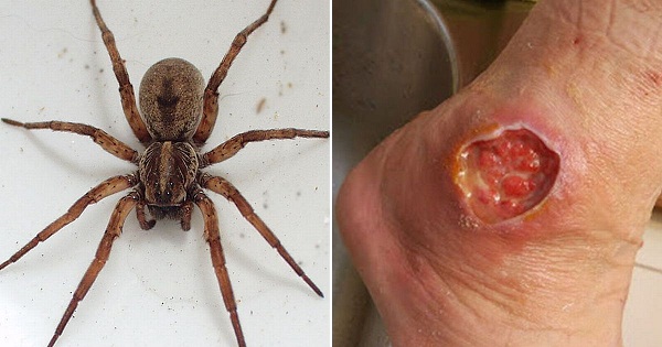brown-recluse-copy